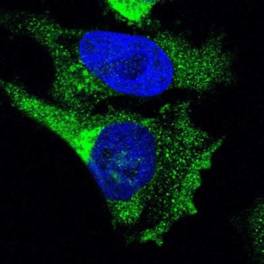 Immunocytochemistry/Immunofluorescence: Ret Antibody [NBP1-84568] - Analysis of human cell line U-251 MG shows positivity in cytoplasm & vesicles. Antibody staining is shown in green.