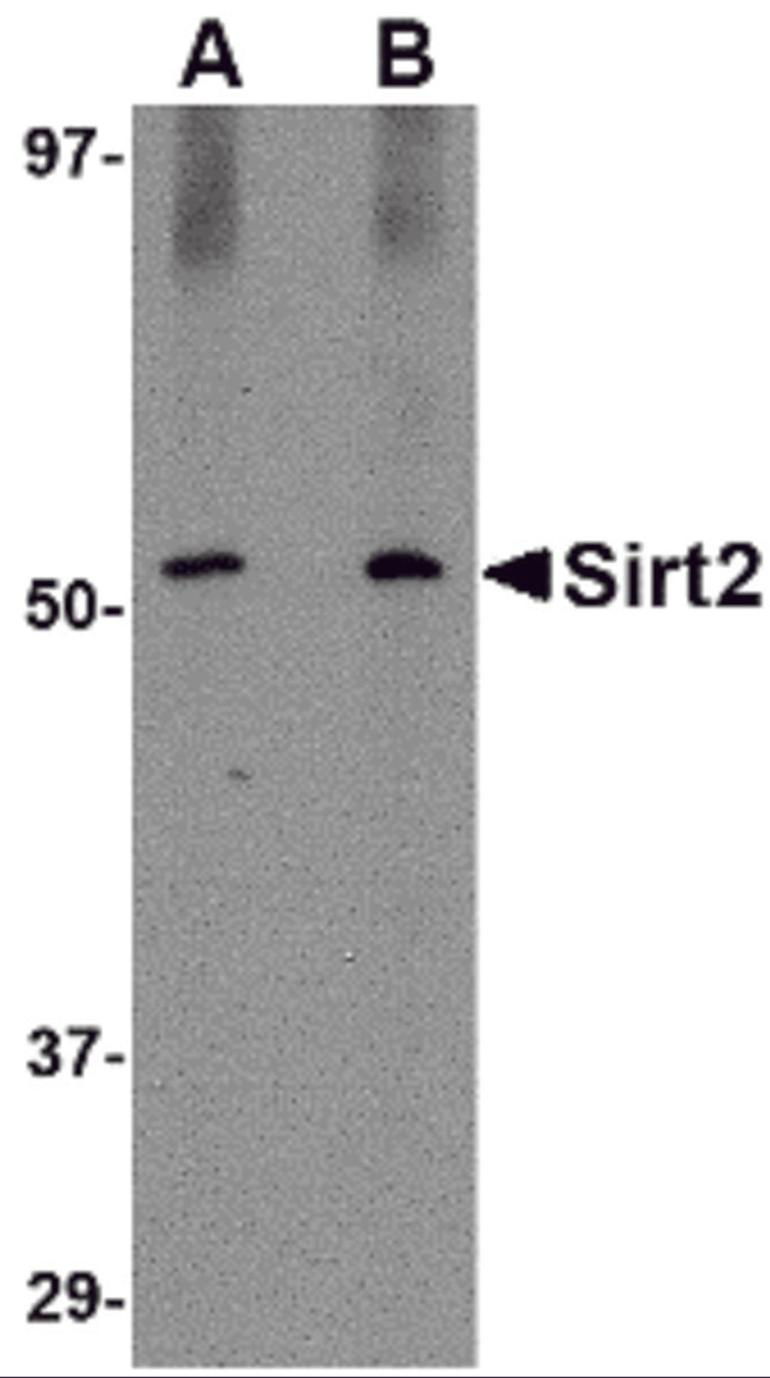 Western blot analysis of SIRT2 in Mouse brain lysate with SIRT2 antibody at (A) 1 and (B) 2 μg/mL.