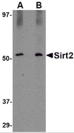 Western blot analysis of SIRT2 in Mouse brain lysate with SIRT2 antibody at (A) 1 and (B) 2 μg/mL.
