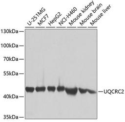 Western blot - UQCRC2 antibody (A4181)