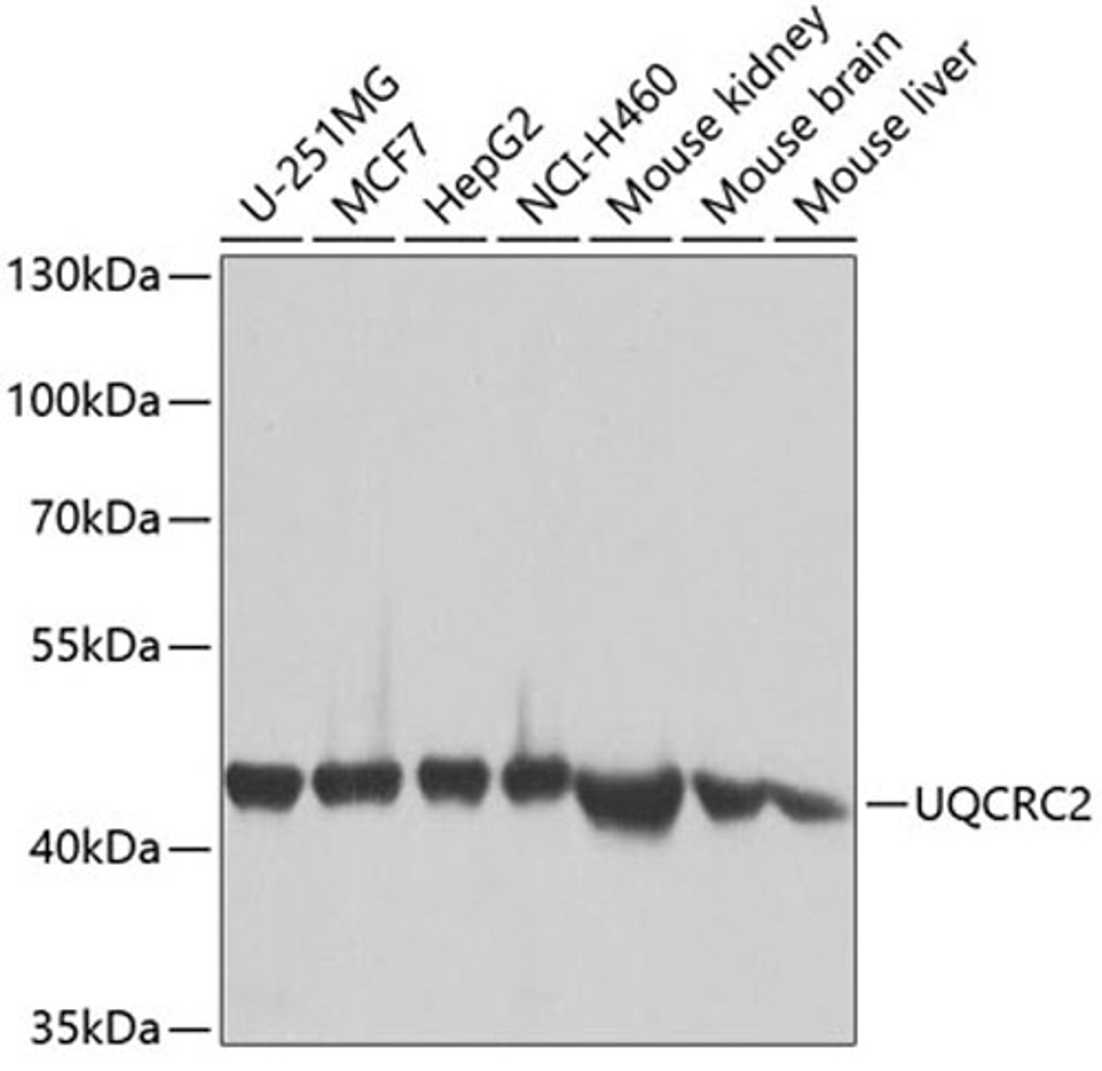 Western blot - UQCRC2 antibody (A4181)