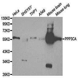 Western blot analysis of extracts of various cell lines using PPP3CA antibody.