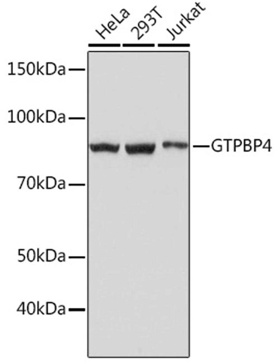 Western blot - GTPBP4 Rabbit mAb (A4743)