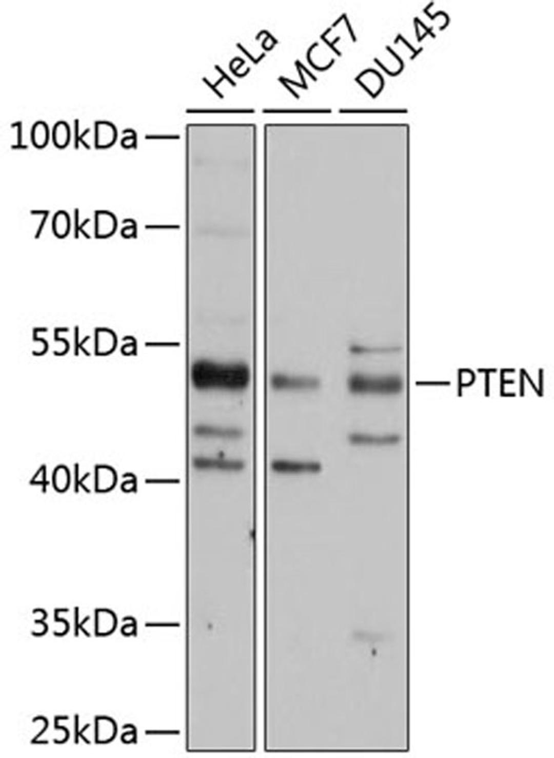 Western blot - PTEN antibody (A11528)