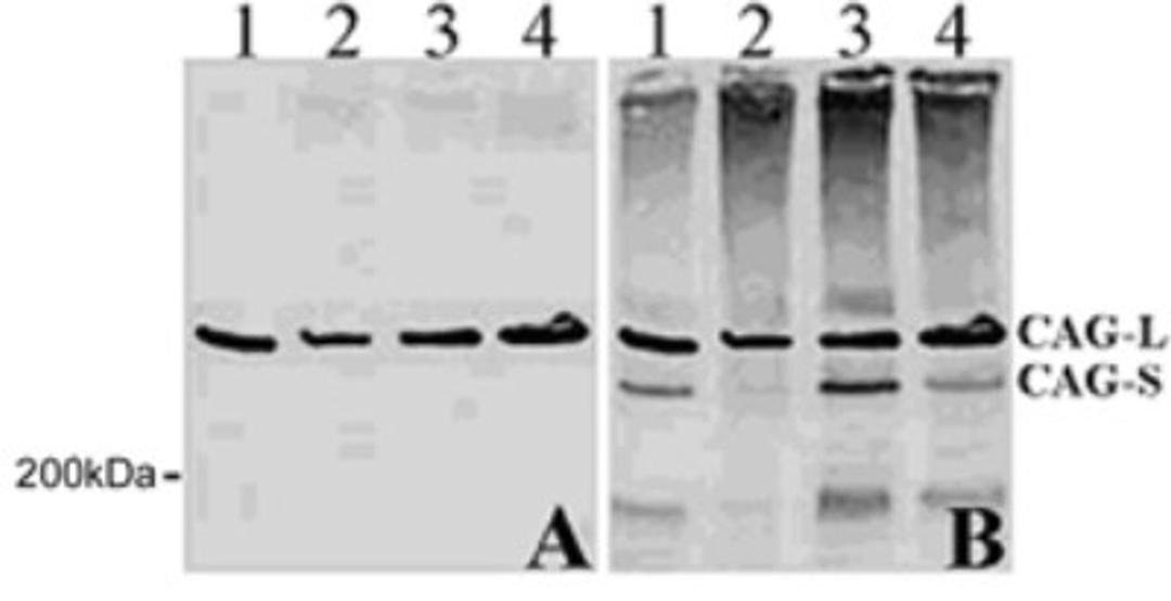 Western Blot: Huntingtin Antibody (1A771) [NB100-56703] - Analysis of Htt in four different lymphoblast HD cell lines extracts each expressing ~65 (mutant) and ~20 (normal) CAG repeats. Lanes 1-4. A, HTT mAb clone 1A771 . B. An Htt antibody recognizing both normal and mutant Htt (B). this antibody. In contrast, the other antibody recognized both the expanded (~65) and normal (~20) repeat Htt forms.