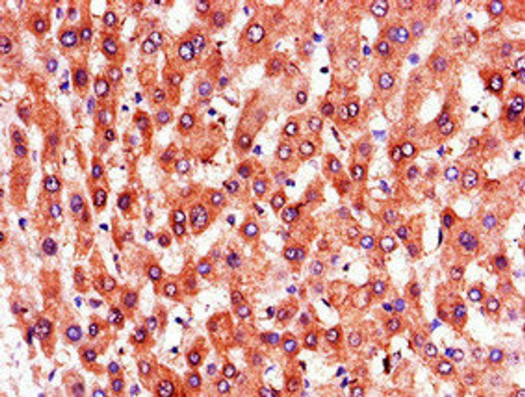 Immunohistochemistry of paraffin-embedded human liver tissue using CSB-PA018983LA01HU at dilution of 1:100
