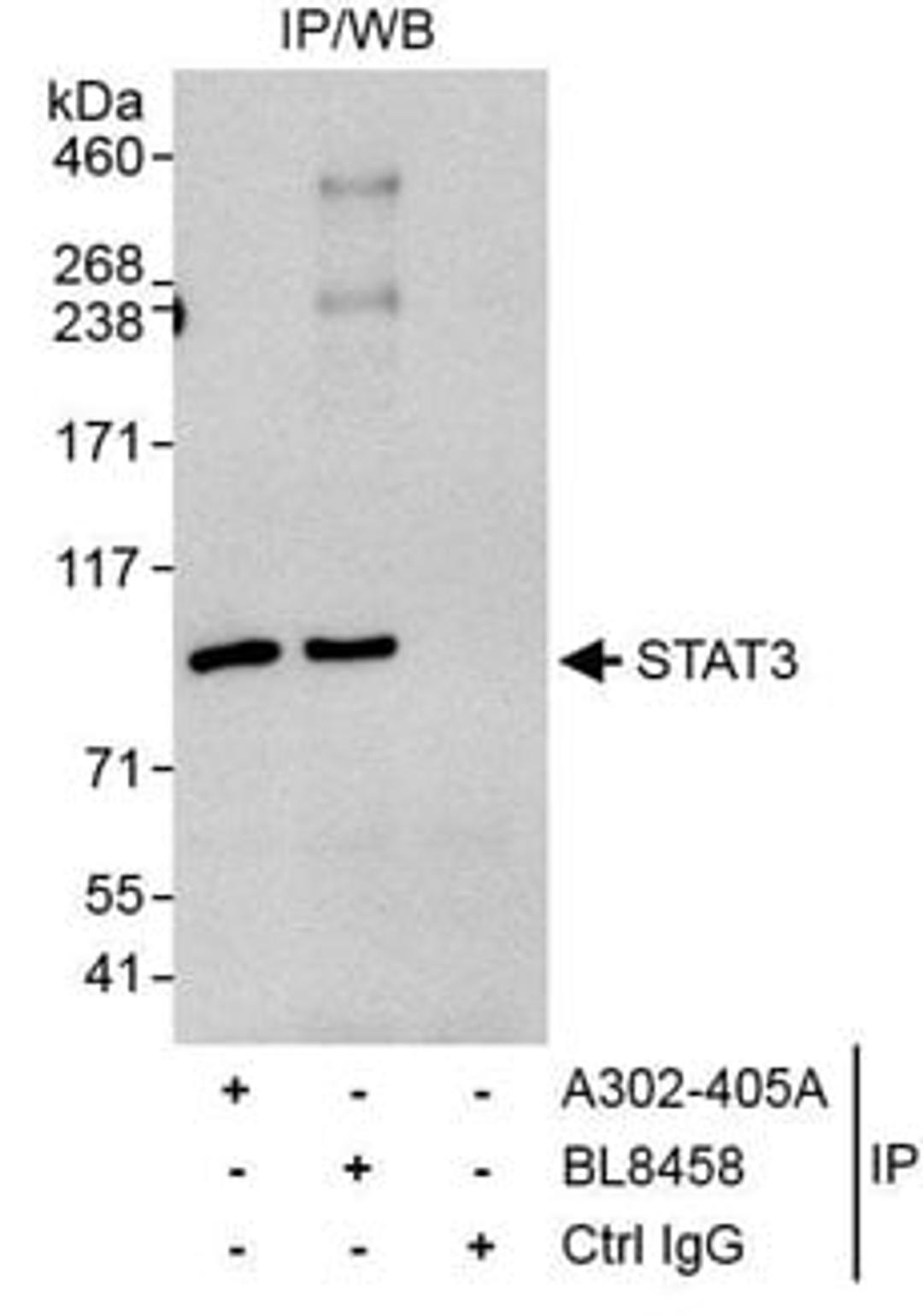 Detection of human STAT3 by western blot of immunoprecipitates.