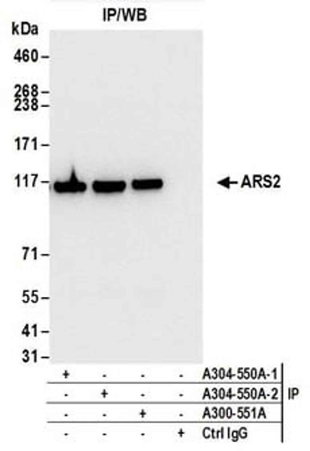 Detection of human ARS2 by western blot of immunoprecipitates.