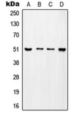 Western blot analysis of MCF7 (Lane 1), SP2/0 (Lane 2), H9C2 (Lane 3), mouse testis (Lane 4) whole cell lysates using TADA2A antibody