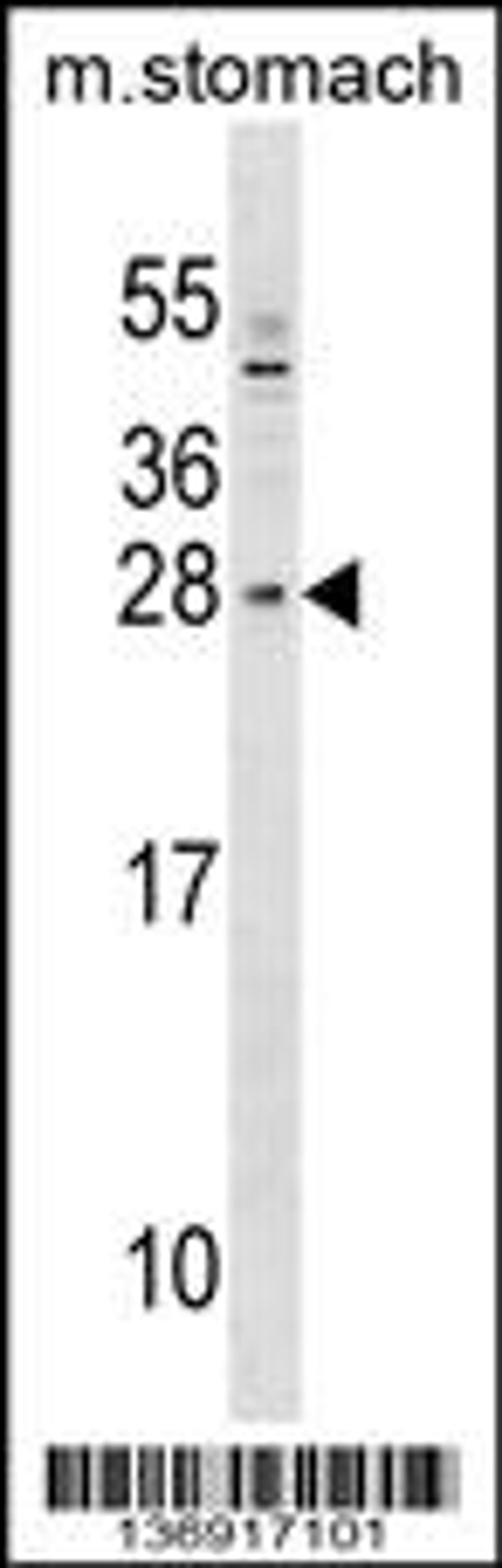 Western blot analysis in mouse stomach tissue lysates (35ug/lane).