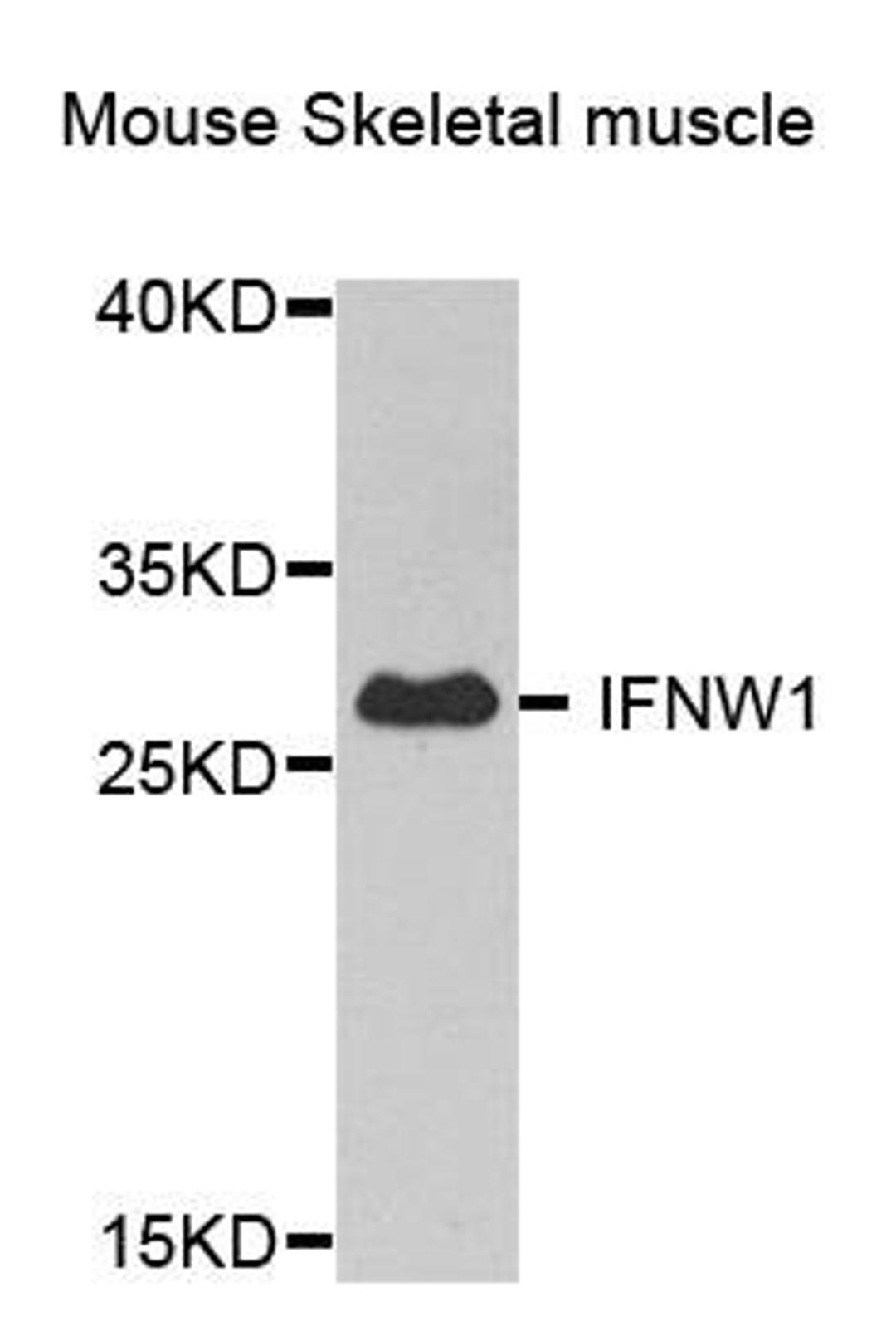 Western blot analysis of extract of various cells using IFNW1 antibody