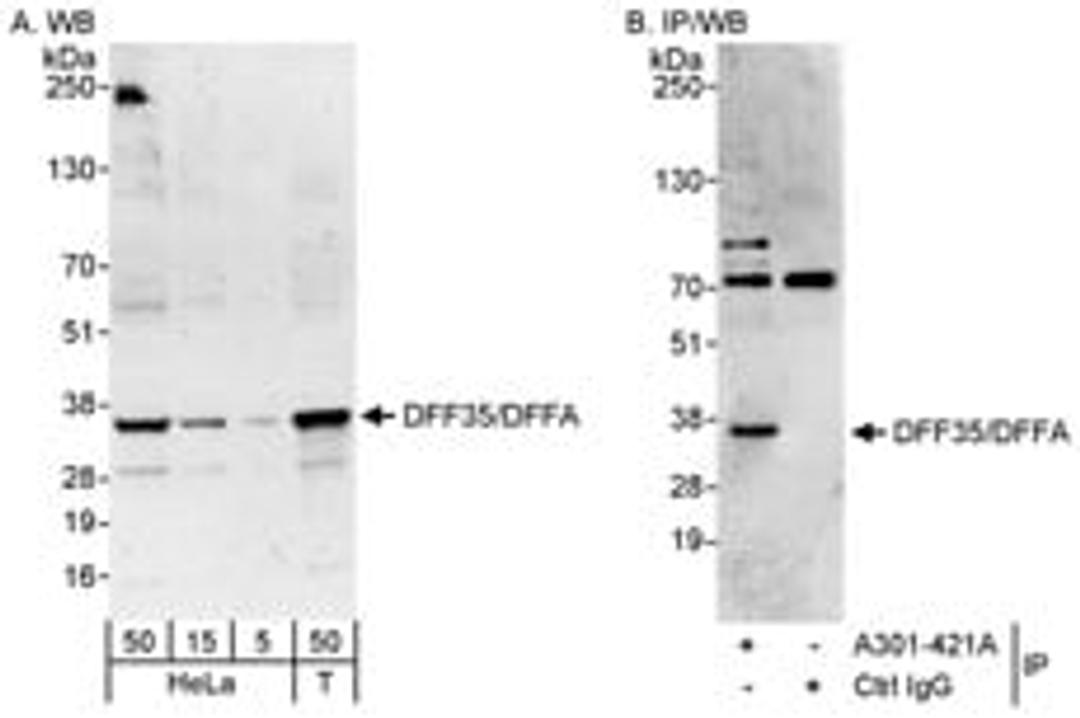 Detection of human DFF35/DFFA by western blot and immunoprecipitation.