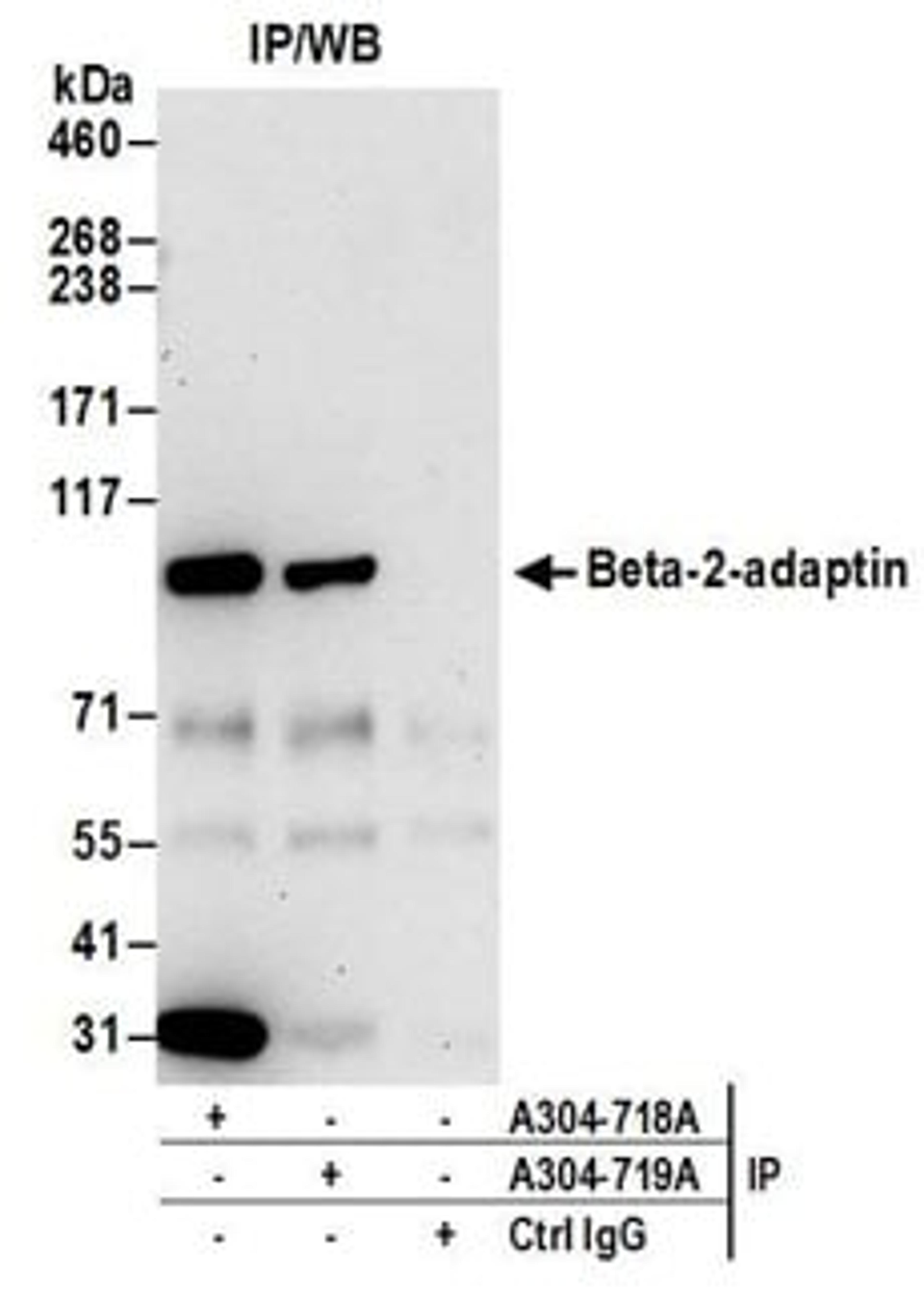 Detection of human Beta-2-adaptin by western blot of immunoprecipitates.