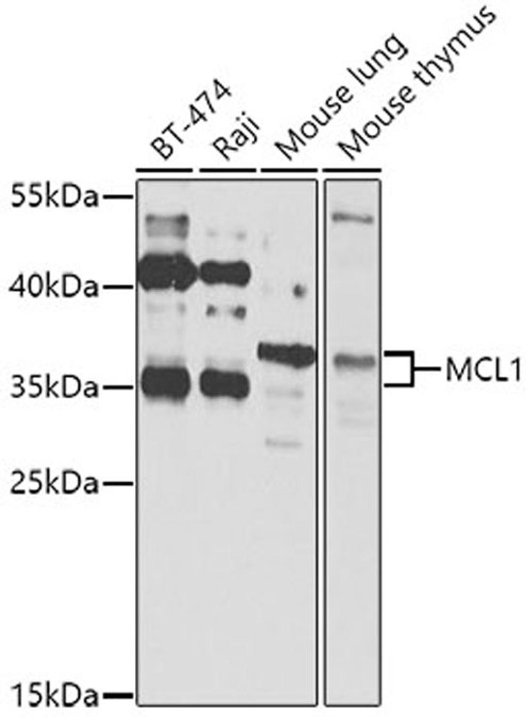 Western blot - MCL1 antibody (A0250)