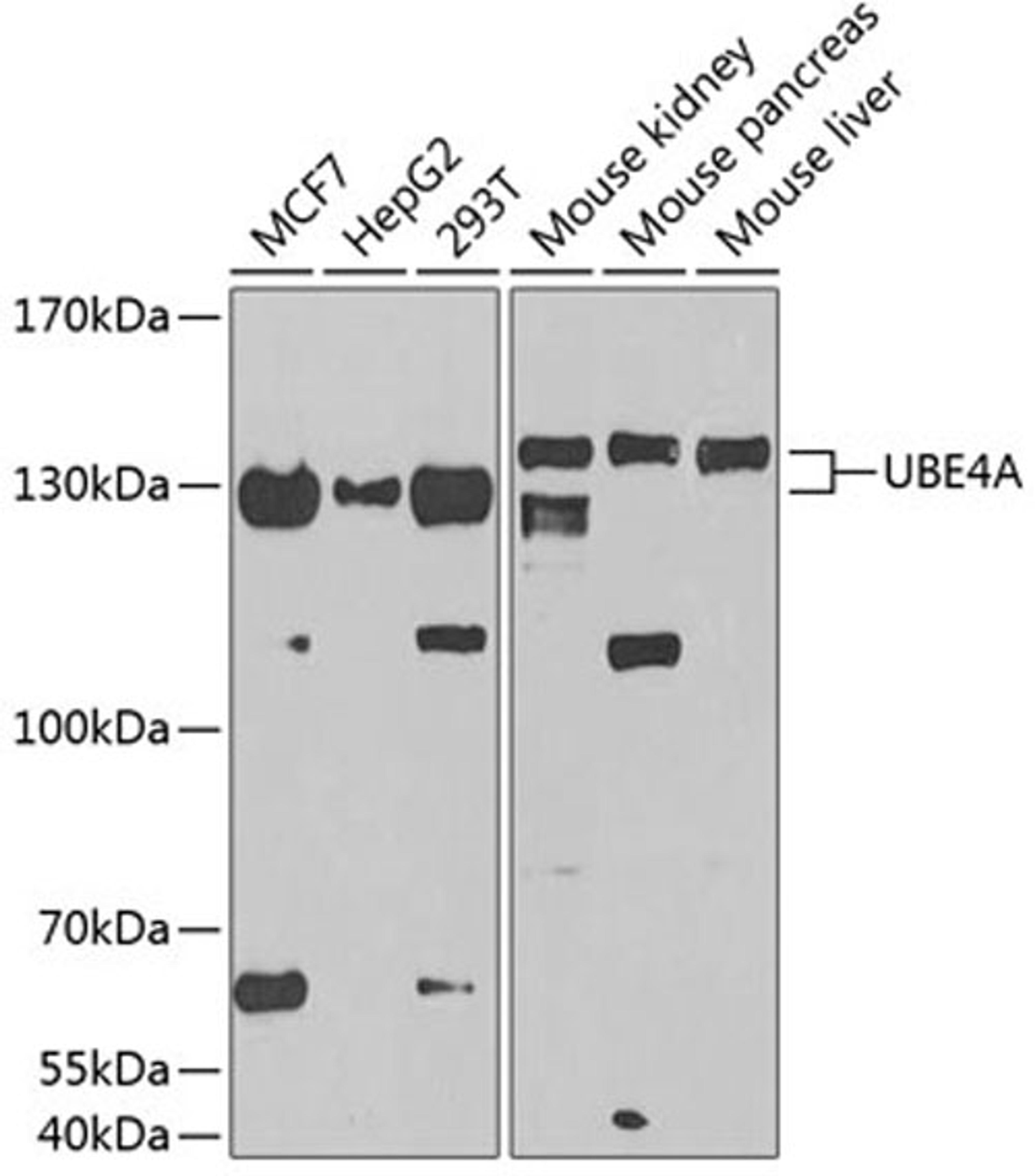 Western blot - UBE4A antibody (A3354)