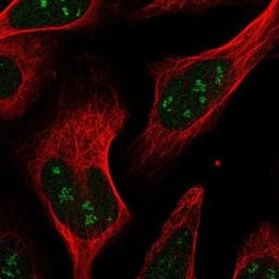 Immunocytochemistry/Immunofluorescence: RPAIN Antibody [NBP1-81706] - Staining of human cell line U-2 OS shows positivity in nucleus & nucleoli.