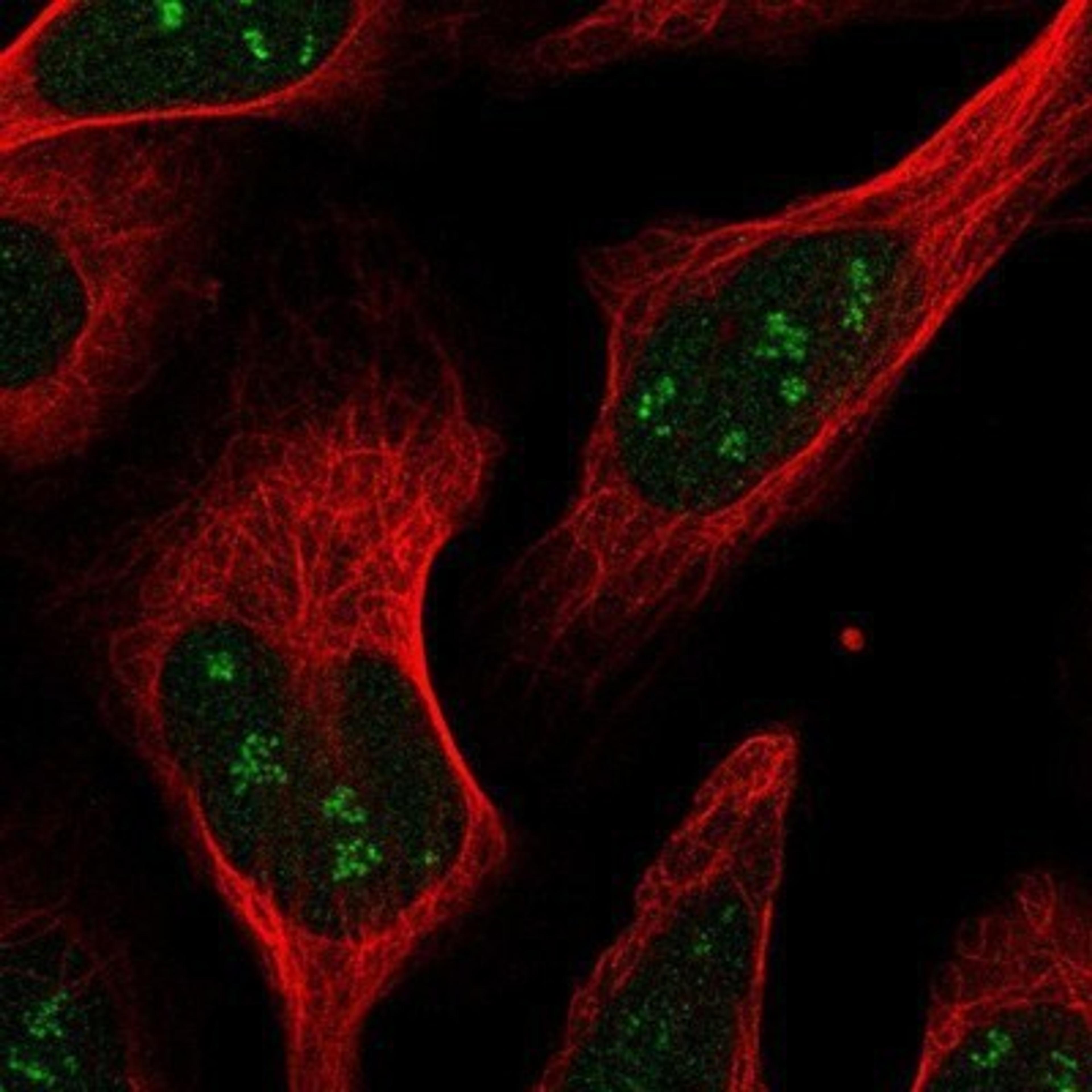 Immunocytochemistry/Immunofluorescence: RPAIN Antibody [NBP1-81706] - Staining of human cell line U-2 OS shows positivity in nucleus & nucleoli.