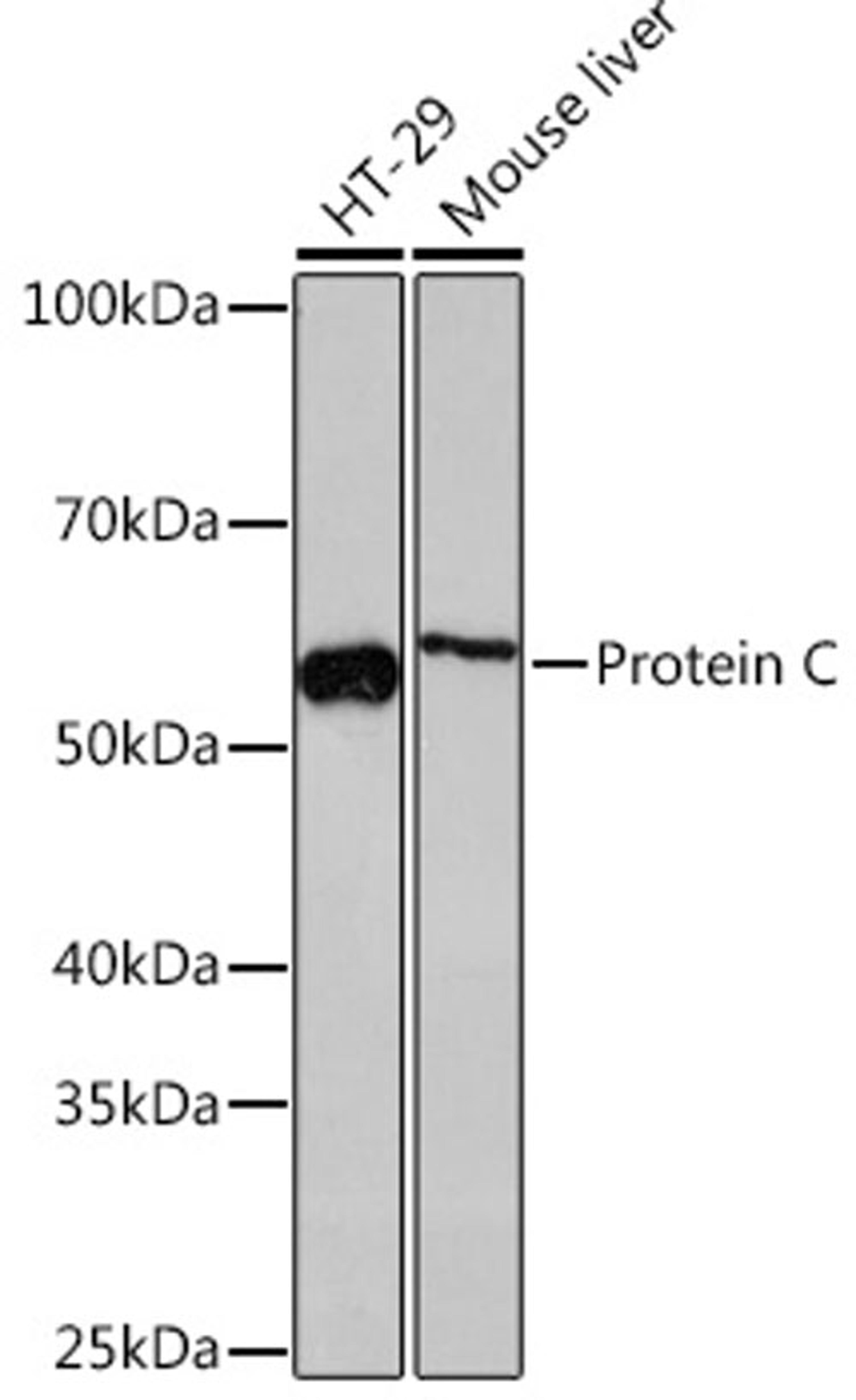 Western blot - Protein C Rabbit mAb (A4532)