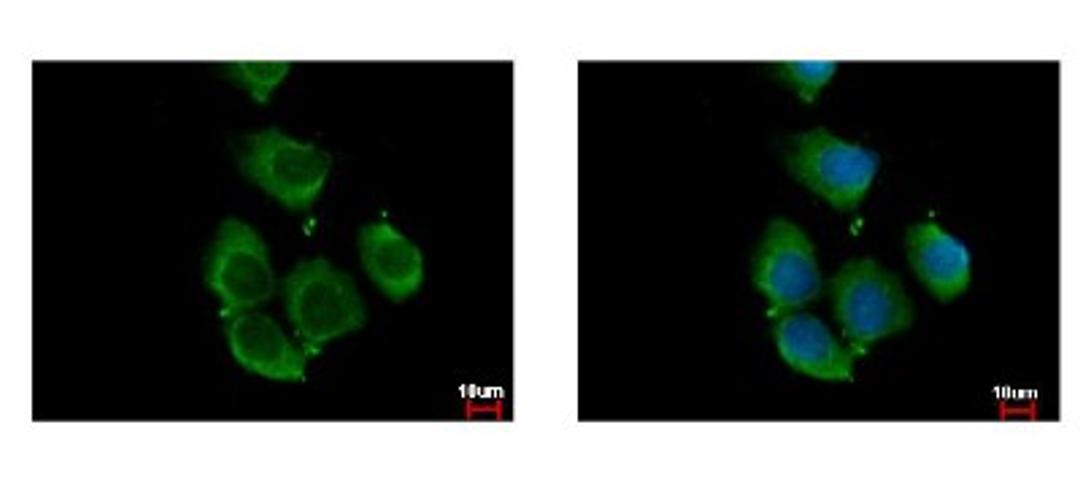 Immunocytochemistry/Immunofluorescence: RhoC Antibody [NBP2-20156] - Sample: A431 cells were fixed in iced-cold MeOH for 5 min. Green: RHOC protein stained by RhoC antibody diluted at 1:500. Blue: Hoechst 33342 staining.