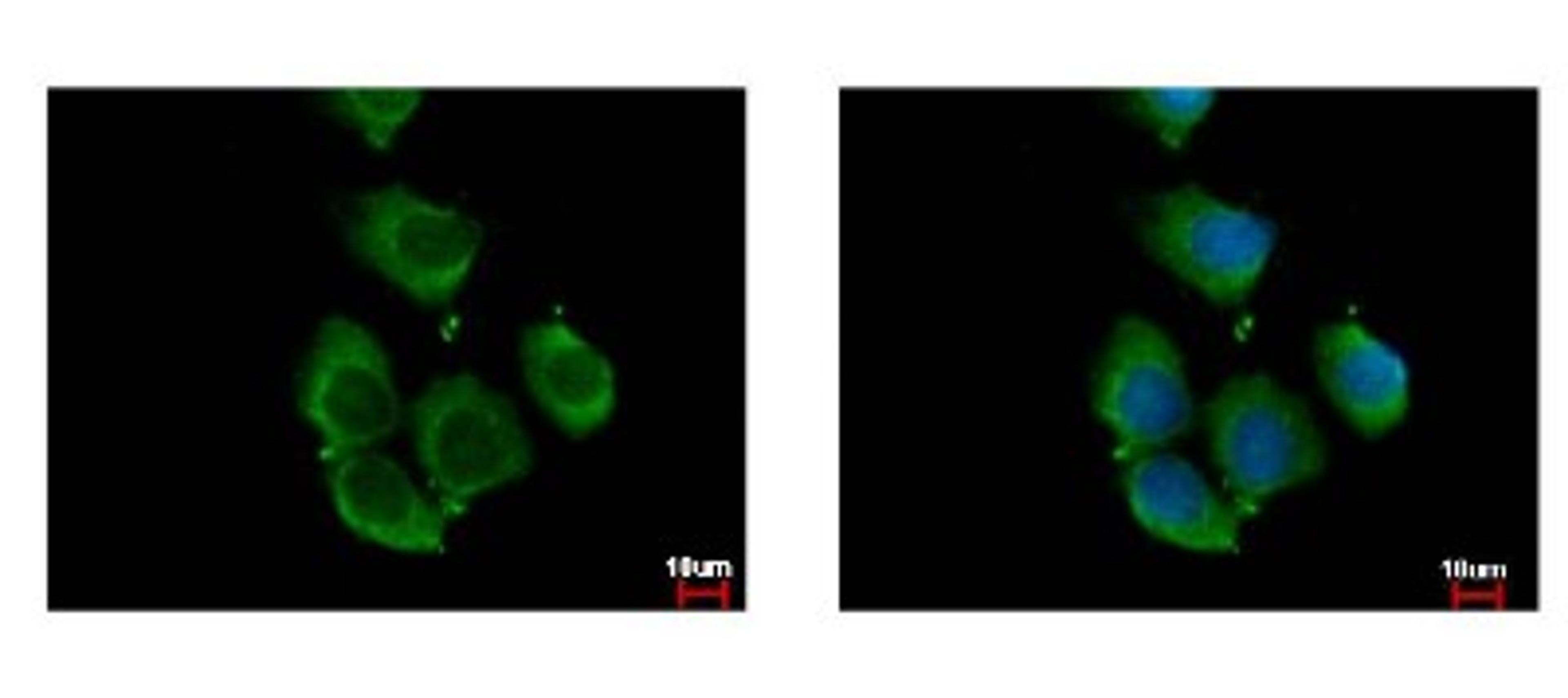 Immunocytochemistry/Immunofluorescence: RhoC Antibody [NBP2-20156] - Sample: A431 cells were fixed in iced-cold MeOH for 5 min. Green: RHOC protein stained by RhoC antibody diluted at 1:500. Blue: Hoechst 33342 staining.