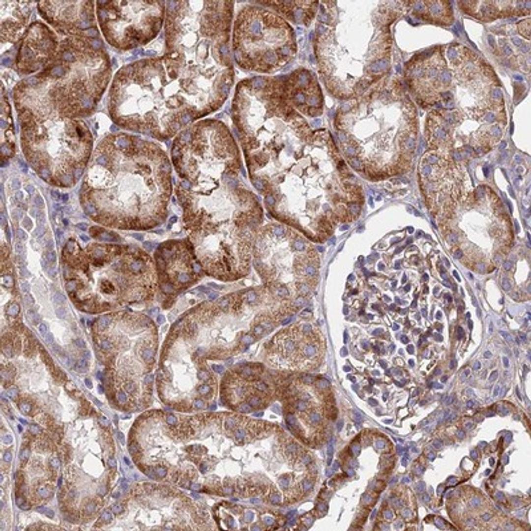 Immunohistochemistry-Paraffin: GPR113 Antibody [NBP1-83262] Staining of human kidney shows distinct cytoplasmic positivity in tubular cells.