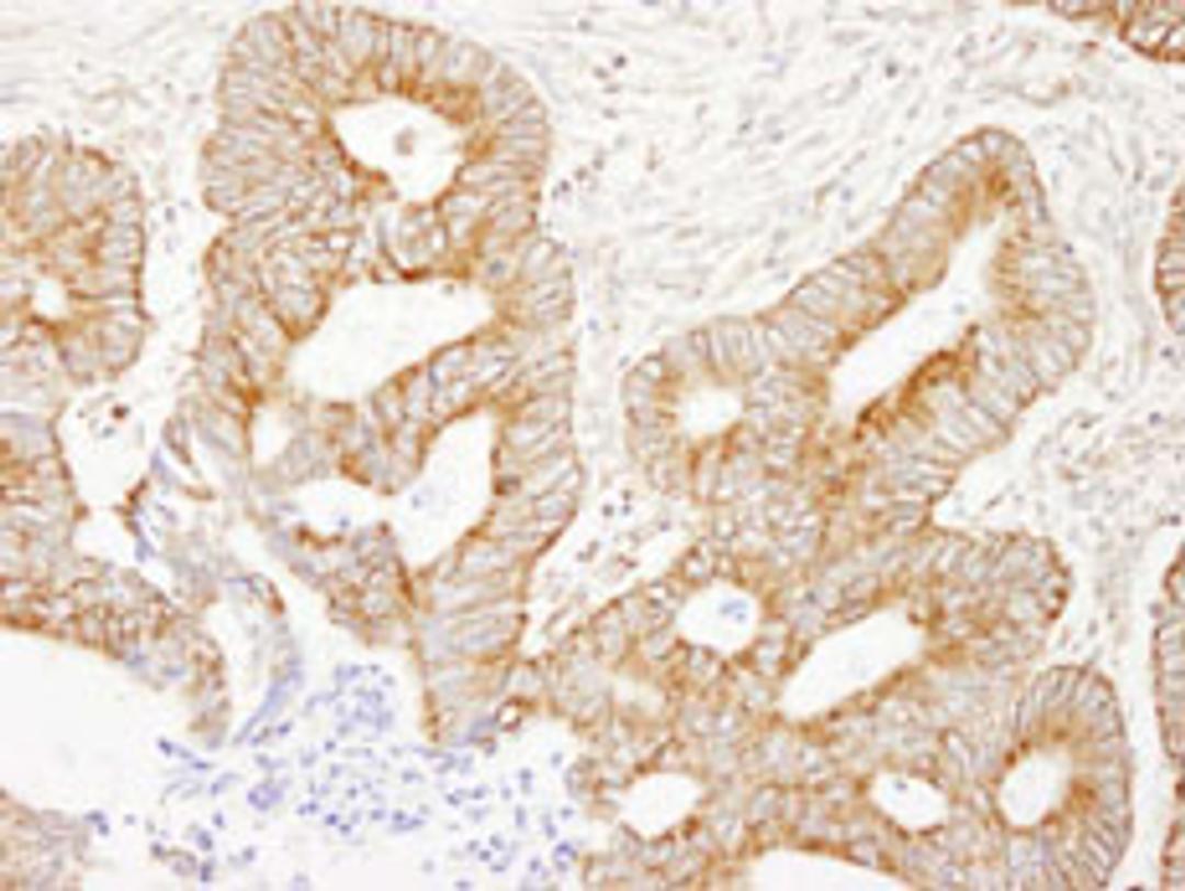 Detection of human AKAP1 by immunohistochemistry.