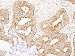 Detection of human AKAP1 by immunohistochemistry.