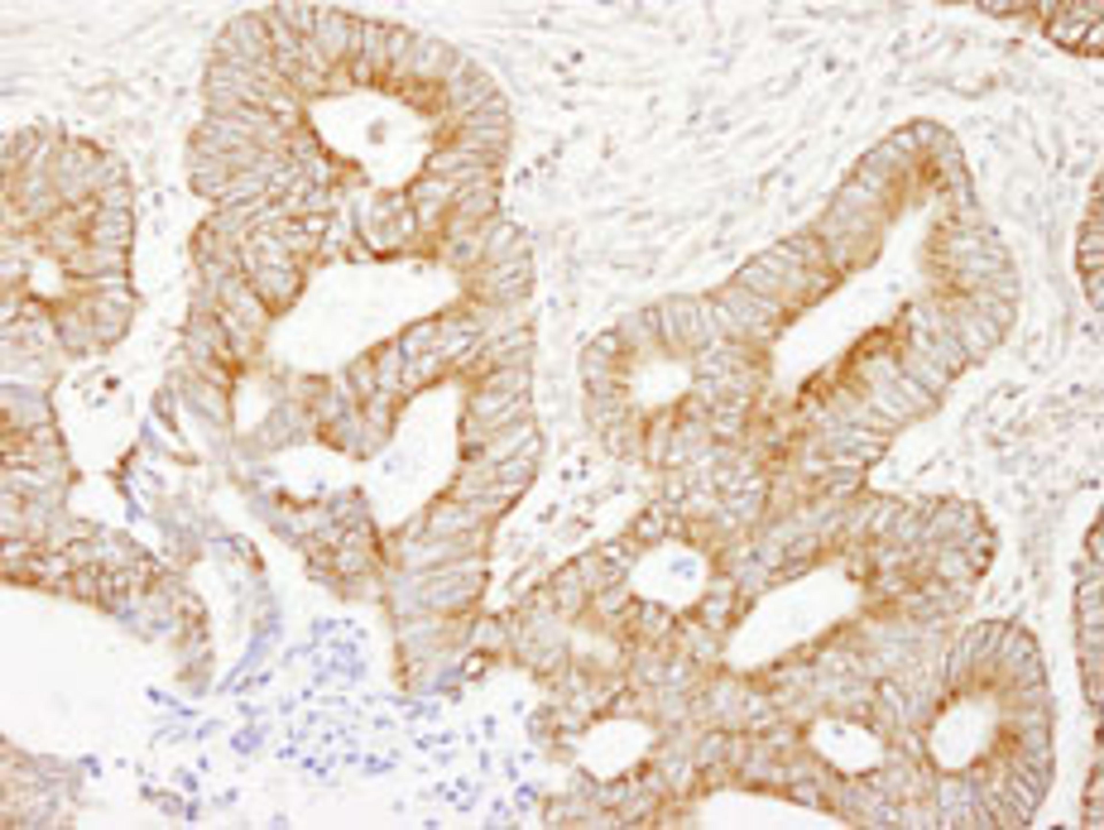 Detection of human AKAP1 by immunohistochemistry.