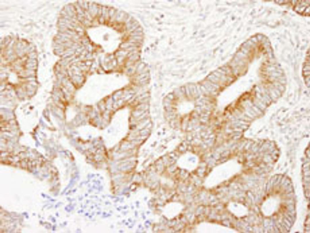 Detection of human AKAP1 by immunohistochemistry.