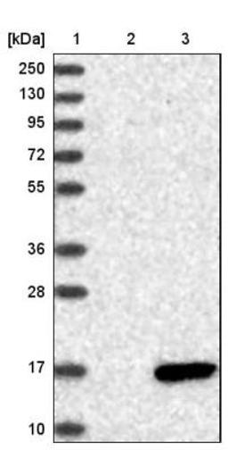 Immunohistochemistry: pS2/Trefoil Factor 1 Antibody [NBP1-90813] - Estrogen Inducible Protein pS2 Antibody [NBP1-90813] - Lane 1: Marker [kDa] 250, 130, 95, 72, 55, 36, 28, 17, 10<br/>Lane 2: Negative control (vector only transfected HEK293T lysate)<br/>Lane 3: Over-expression lysate (Co-expressed with a C-terminal myc-DDK tag (~3.1 kDa) in mammalian HEK293T cells, LY418822)