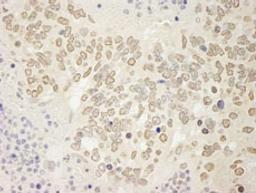 Detection of mouse USP15 by immunohistochemistry.