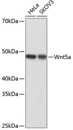 Western blot - Wnt5a antibody (A19133)