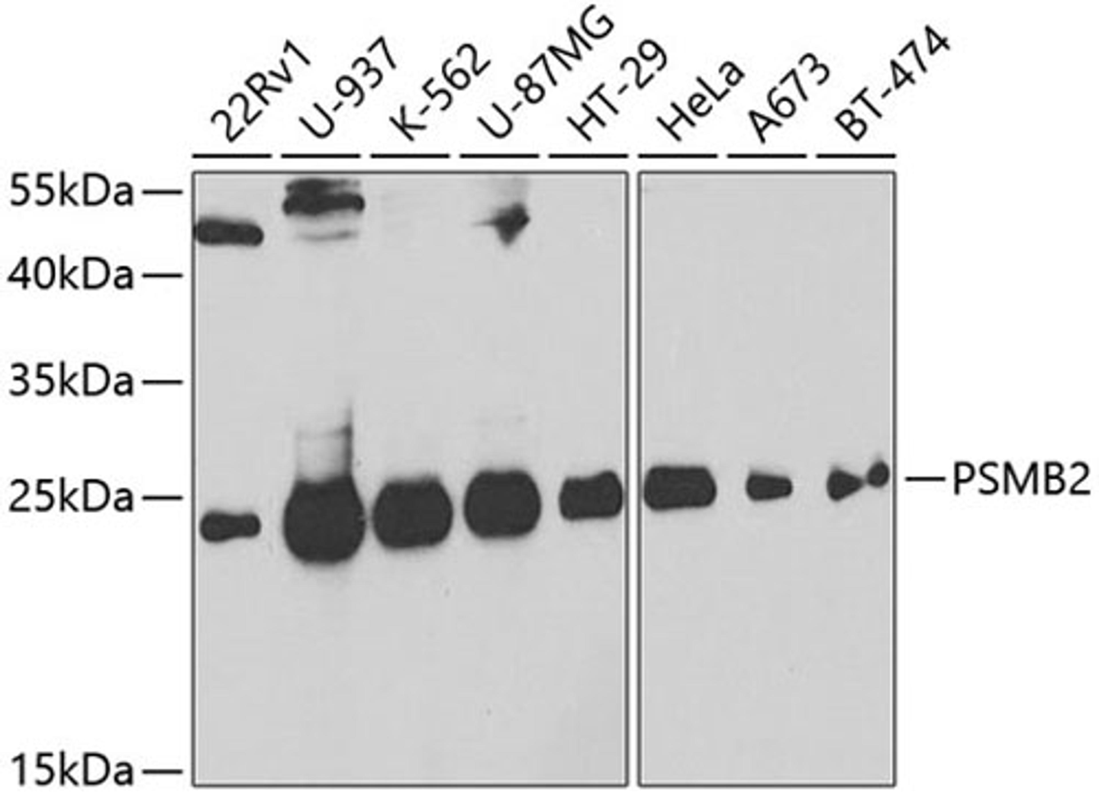 Western blot - PSMB2 antibody (A5483)