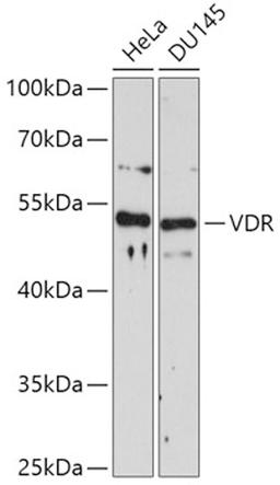 Western blot - VDR antibody (A11743)