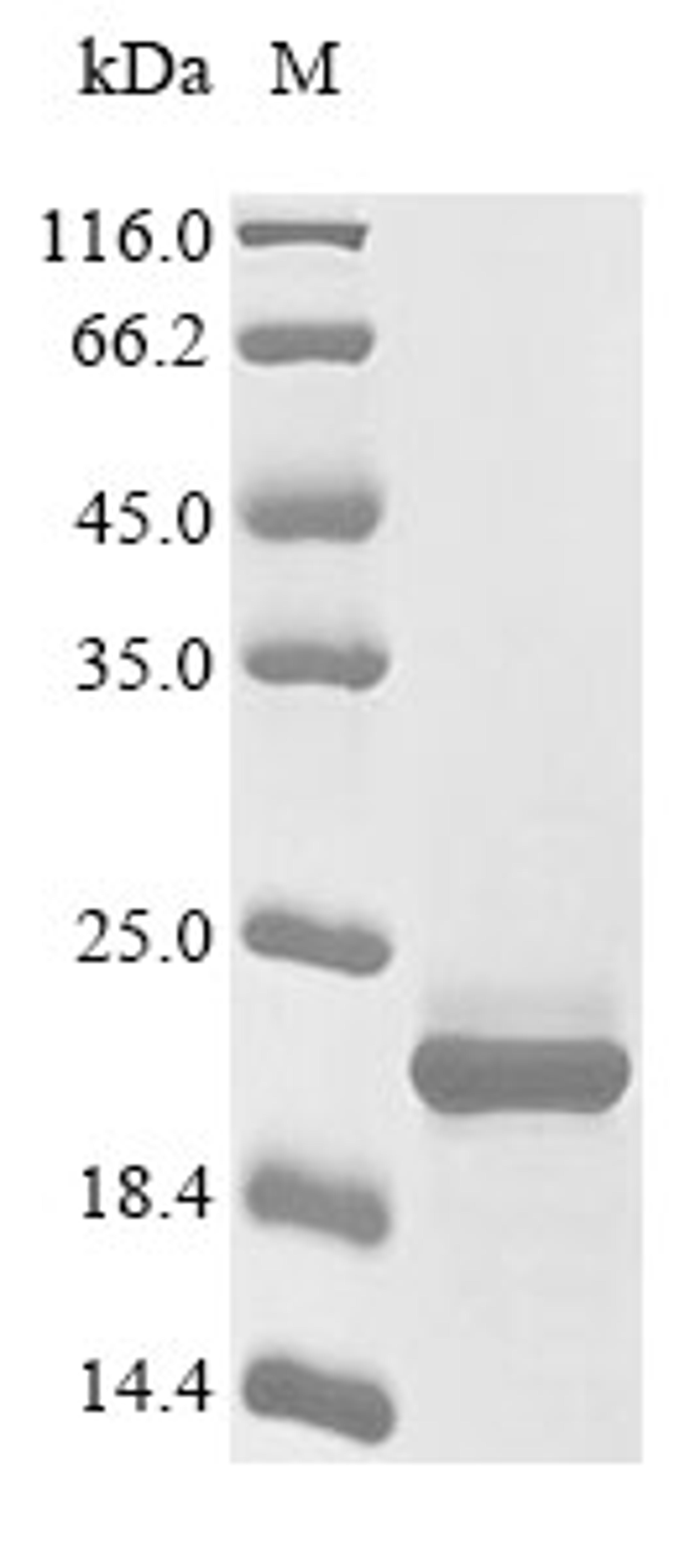 (Tris-Glycine gel) Discontinuous SDS-PAGE (reduced) with 5% enrichment gel and 15% separation gel.