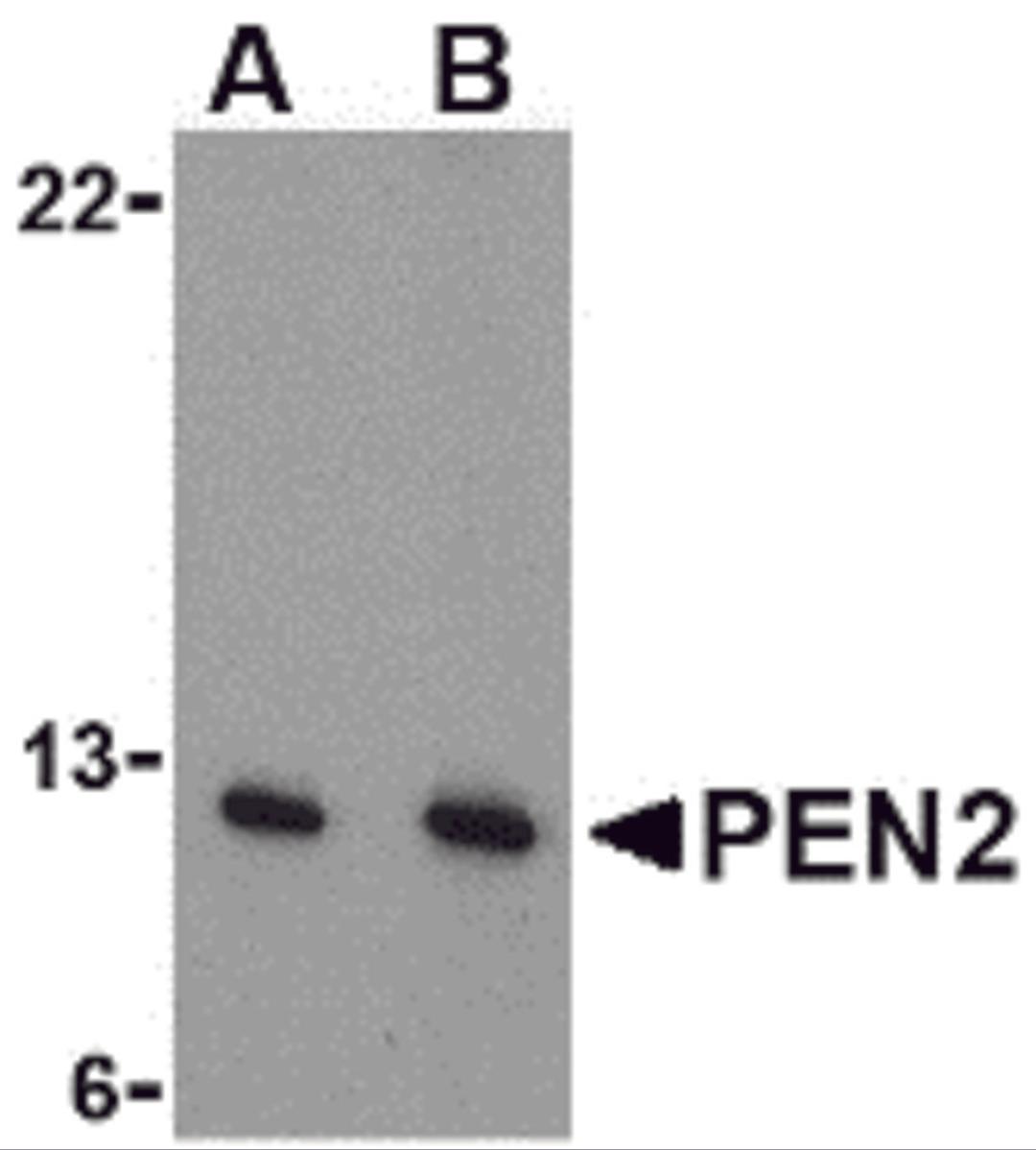 Western blot analysis of PEN2 in A-20 cell lysate with PEN2 antibody at (A) 0.5 and (B) 1 μg/mL.
