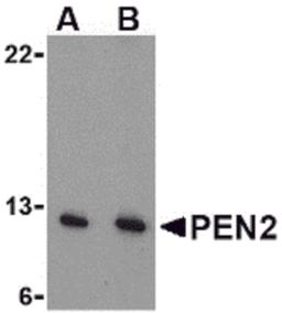 Western blot analysis of PEN2 in A-20 cell lysate with PEN2 antibody at (A) 0.5 and (B) 1 μg/mL.