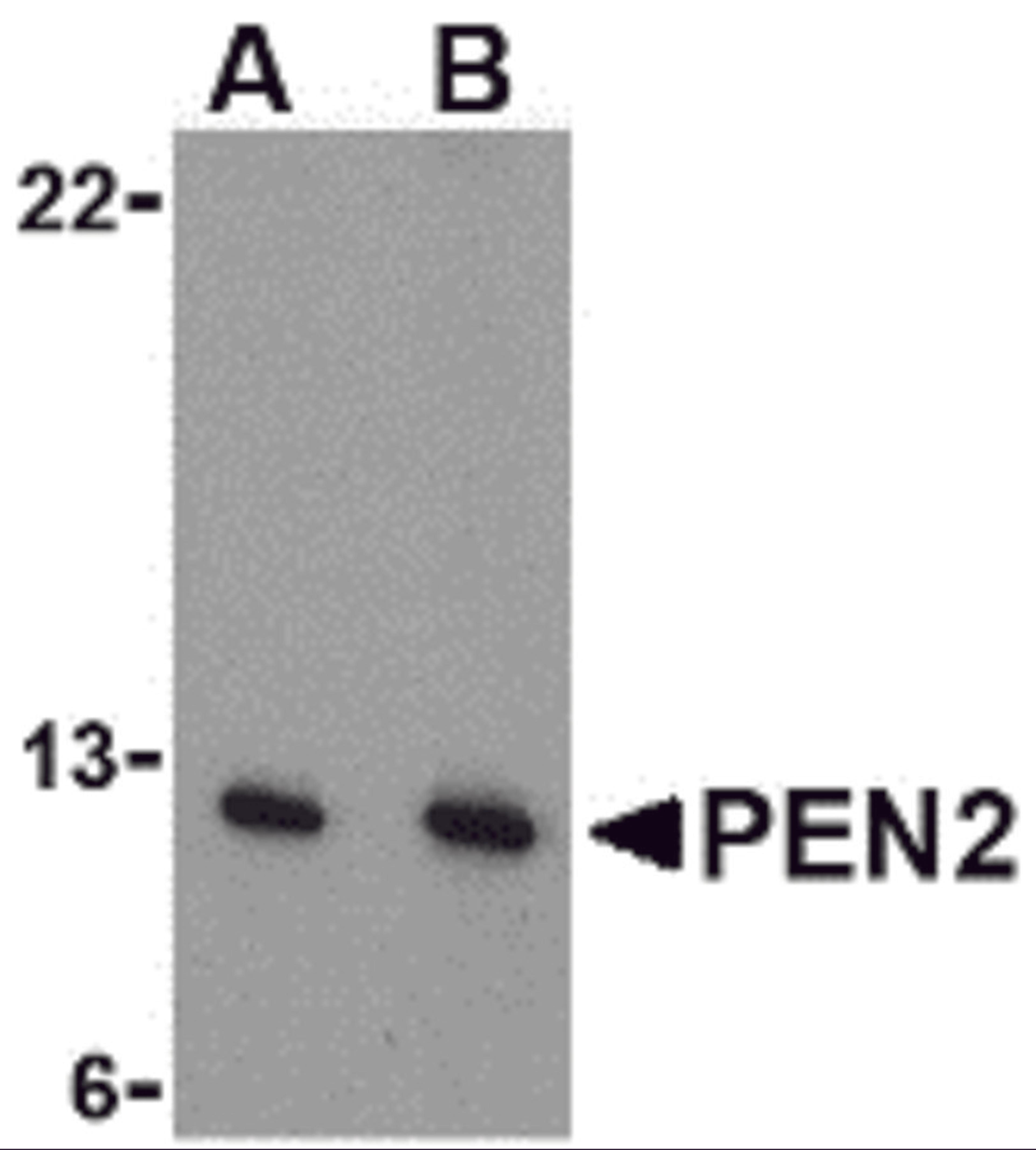Western blot analysis of PEN2 in A-20 cell lysate with PEN2 antibody at (A) 0.5 and (B) 1 μg/mL.