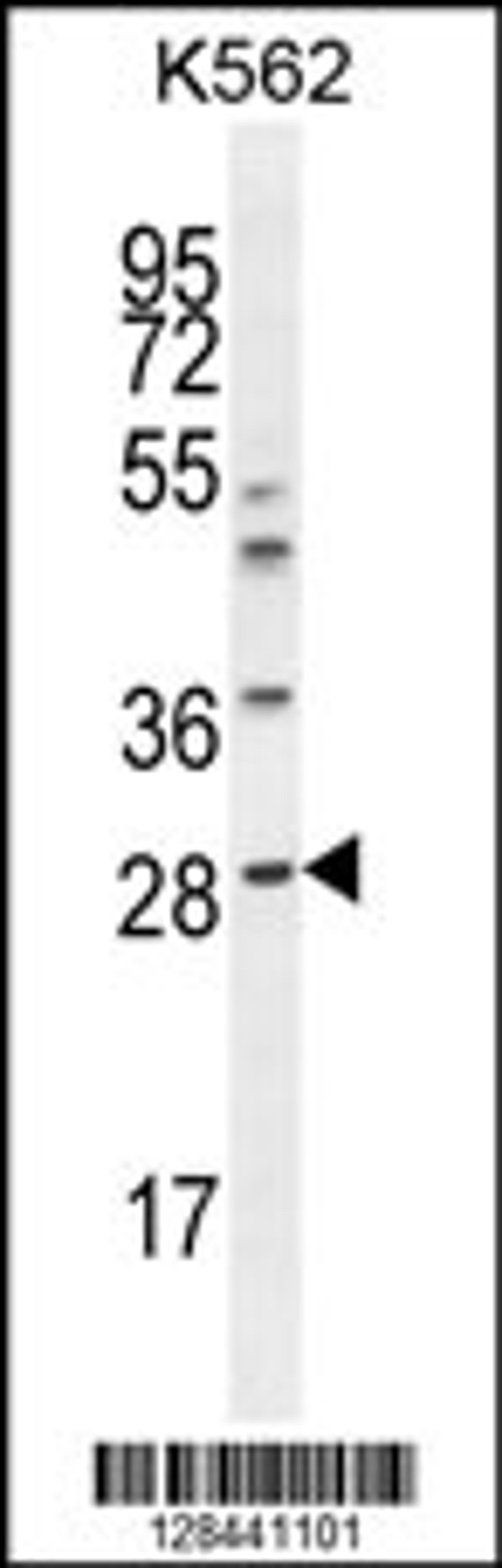 Western blot analysis in K562 cell line lysates (35ug/lane).