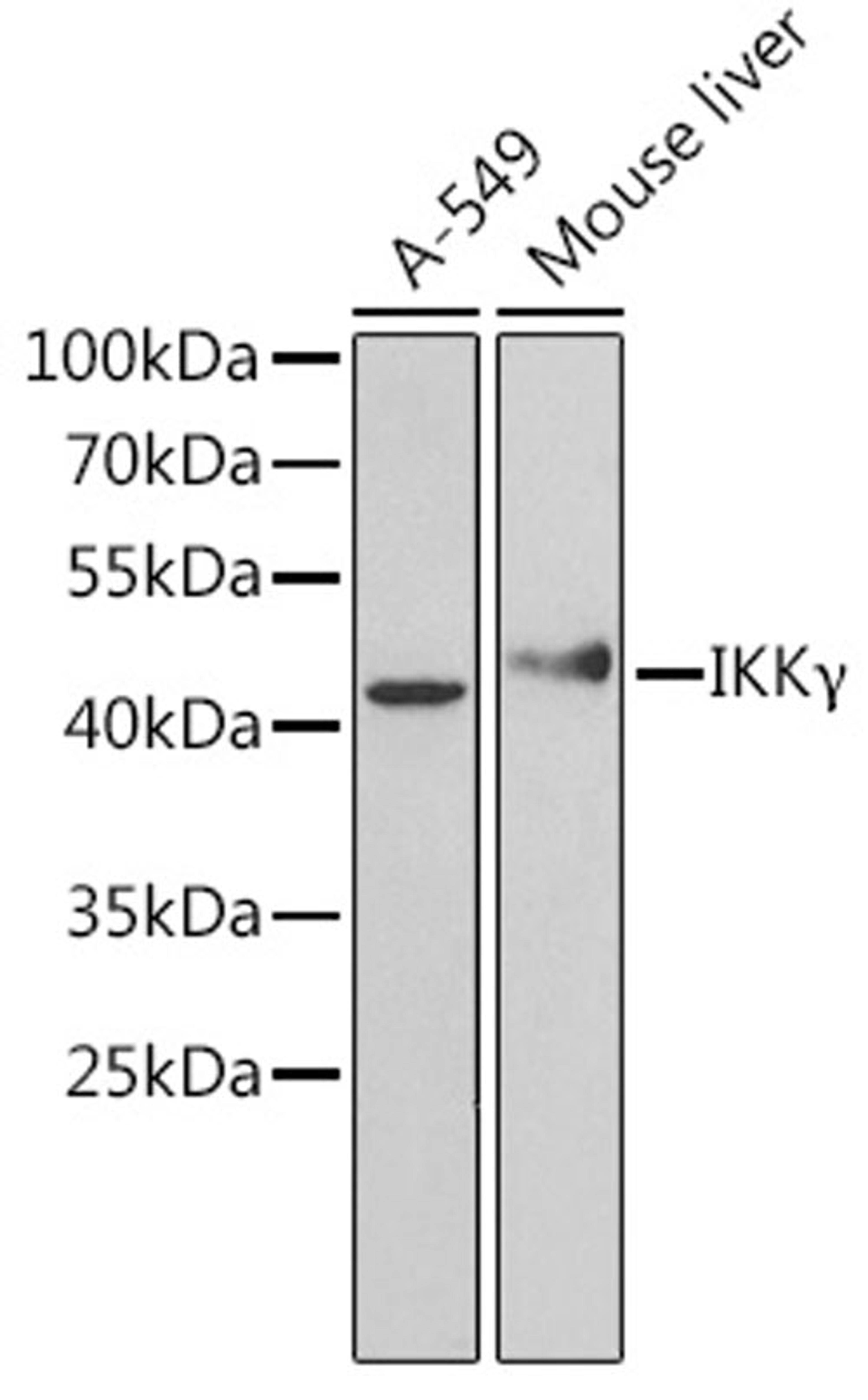 Western blot - IKK? Antibody (A12536)