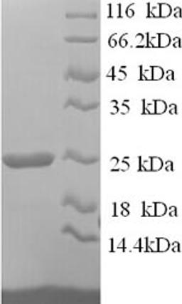 (Tris-Glycine gel) Discontinuous SDS-PAGE (reduced) with 5% enrichment gel and 15% separation gel.