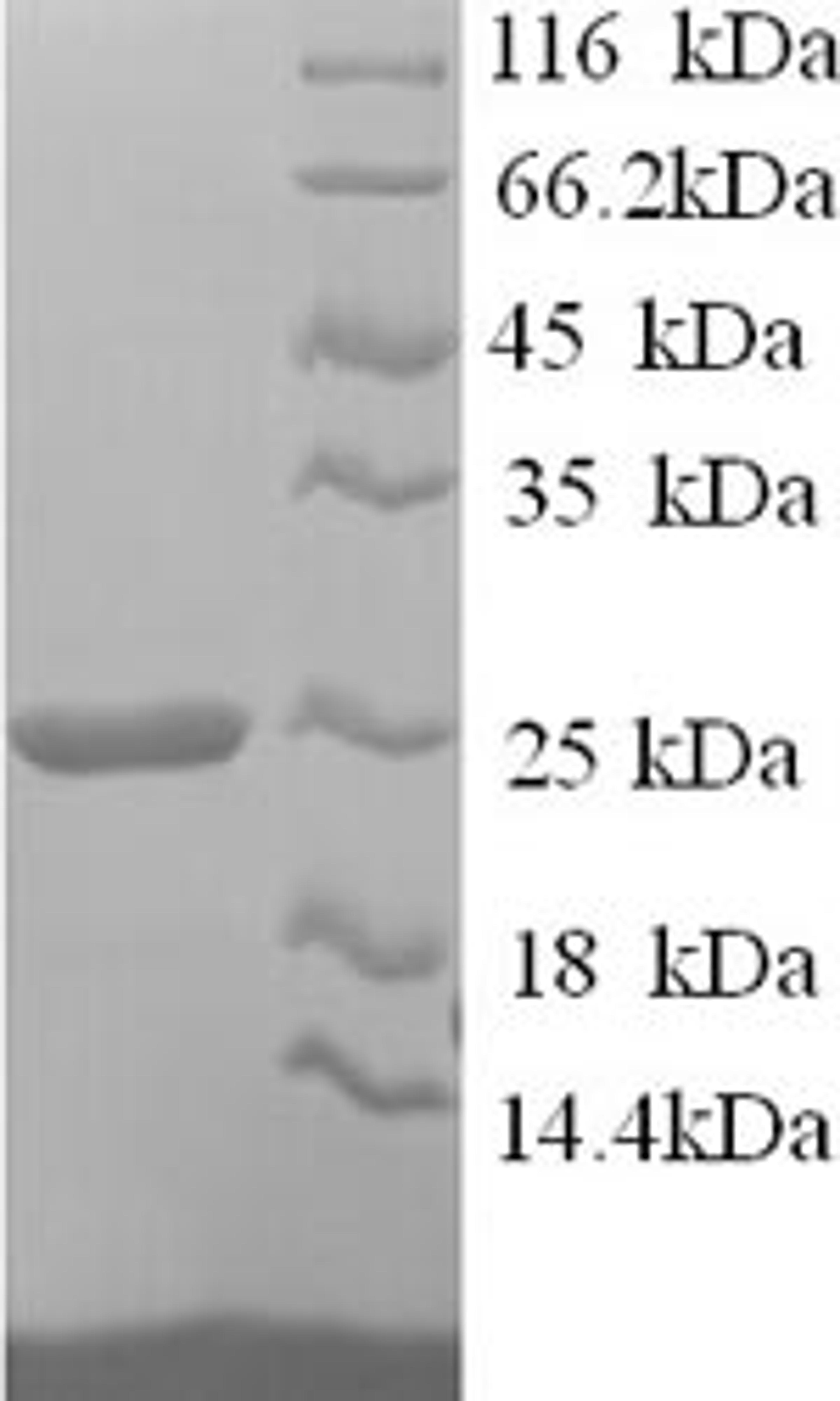 (Tris-Glycine gel) Discontinuous SDS-PAGE (reduced) with 5% enrichment gel and 15% separation gel.
