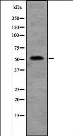 Western blot analysis of Jurkat cell lysate using SEPT10 antibody