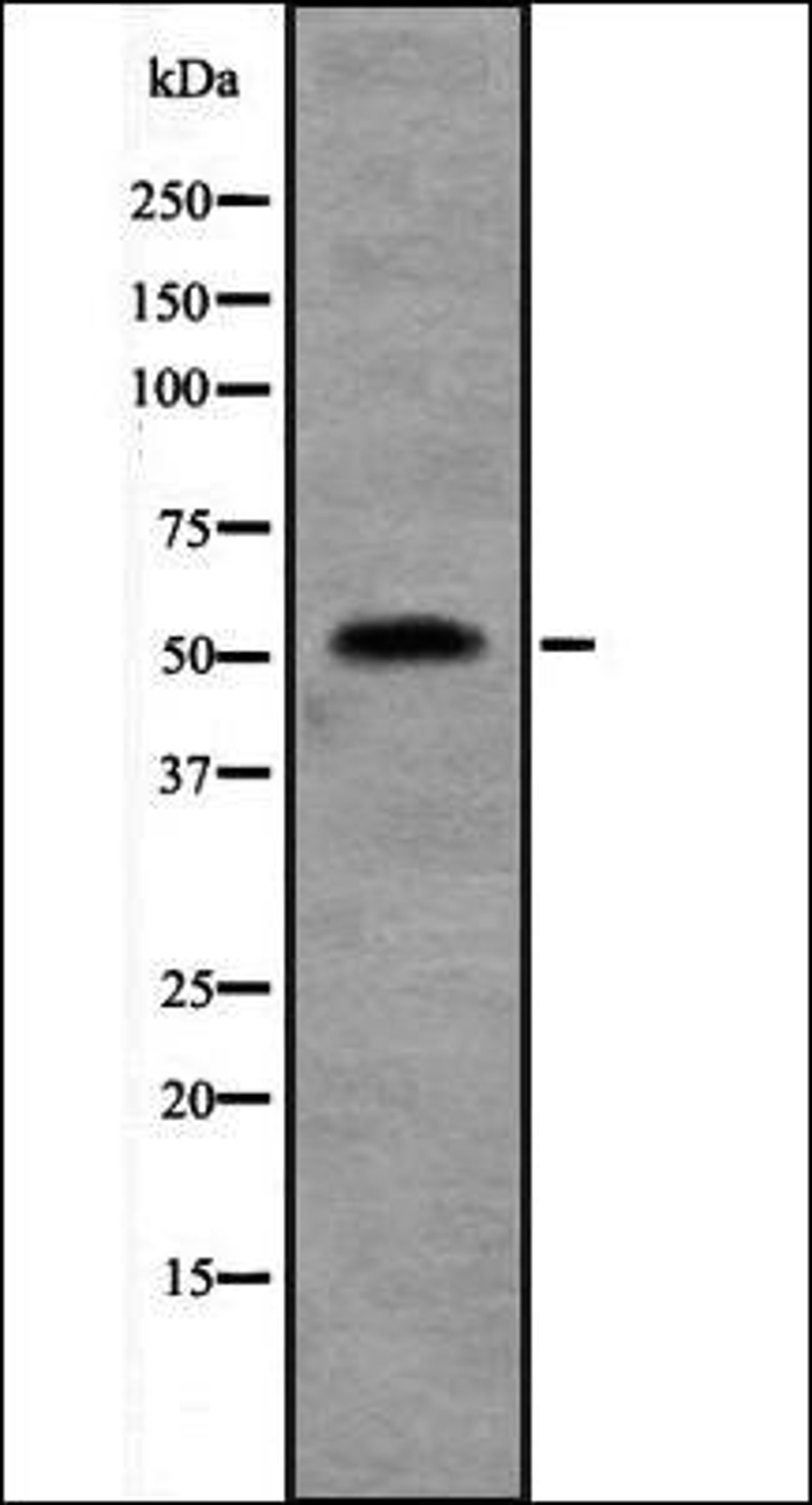 Western blot analysis of Jurkat cell lysate using SEPT10 antibody