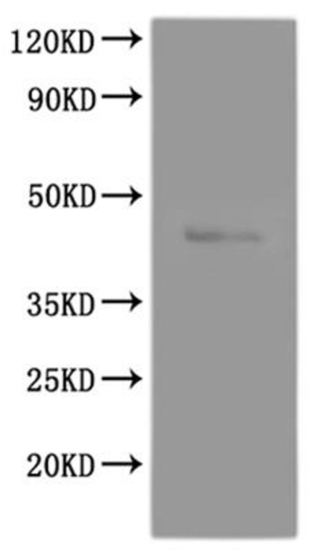 CSB-MP009911RA2 is detected by Mouse anti-6*His monoclonal antibody.