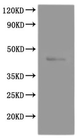 CSB-MP009911RA2 is detected by Mouse anti-6*His monoclonal antibody.