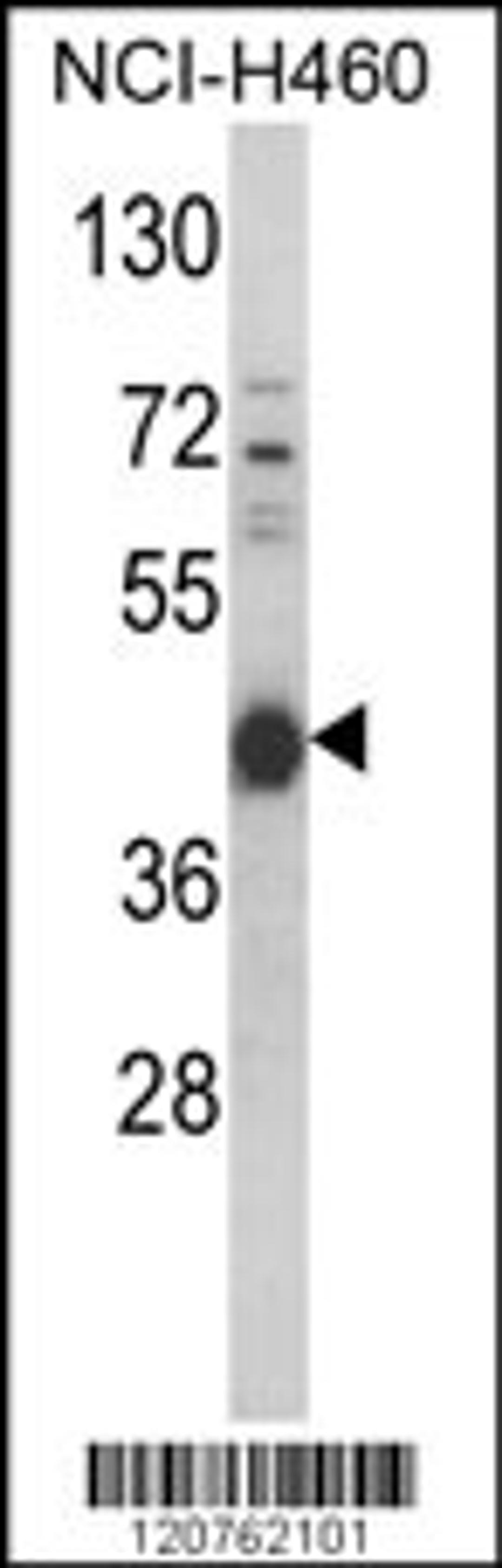 Western blot analysis of PRKACA Antibody (N-term K82) in NCI-H460 cell line lysates (35ug/lane)