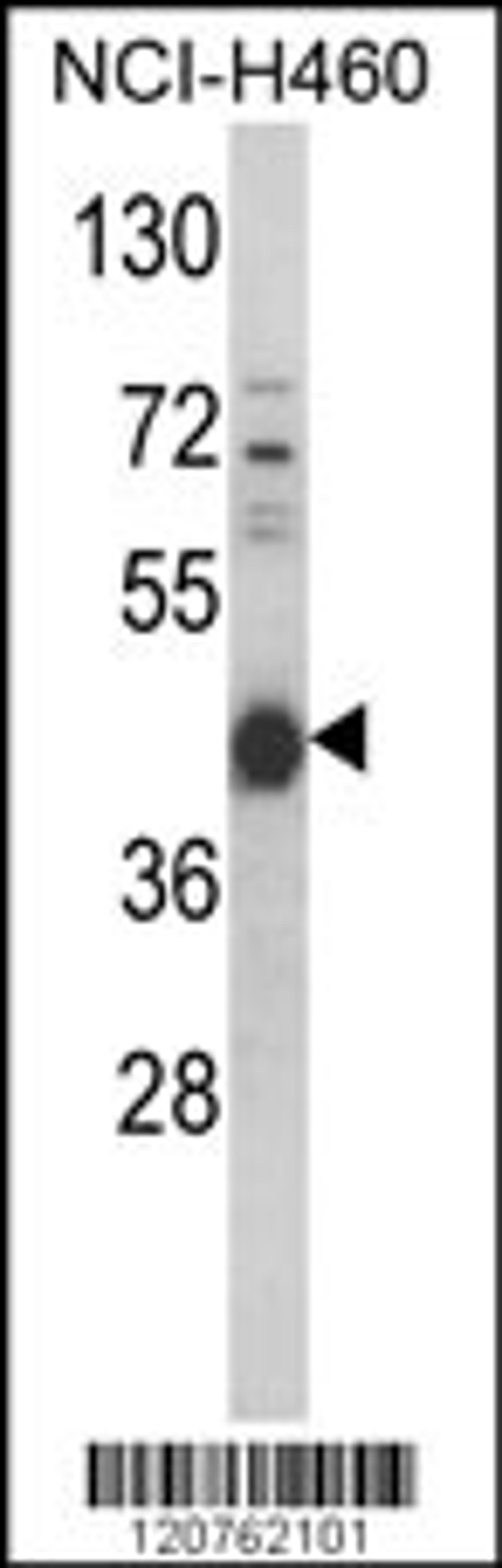 Western blot analysis of PRKACA Antibody (N-term K82) in NCI-H460 cell line lysates (35ug/lane)