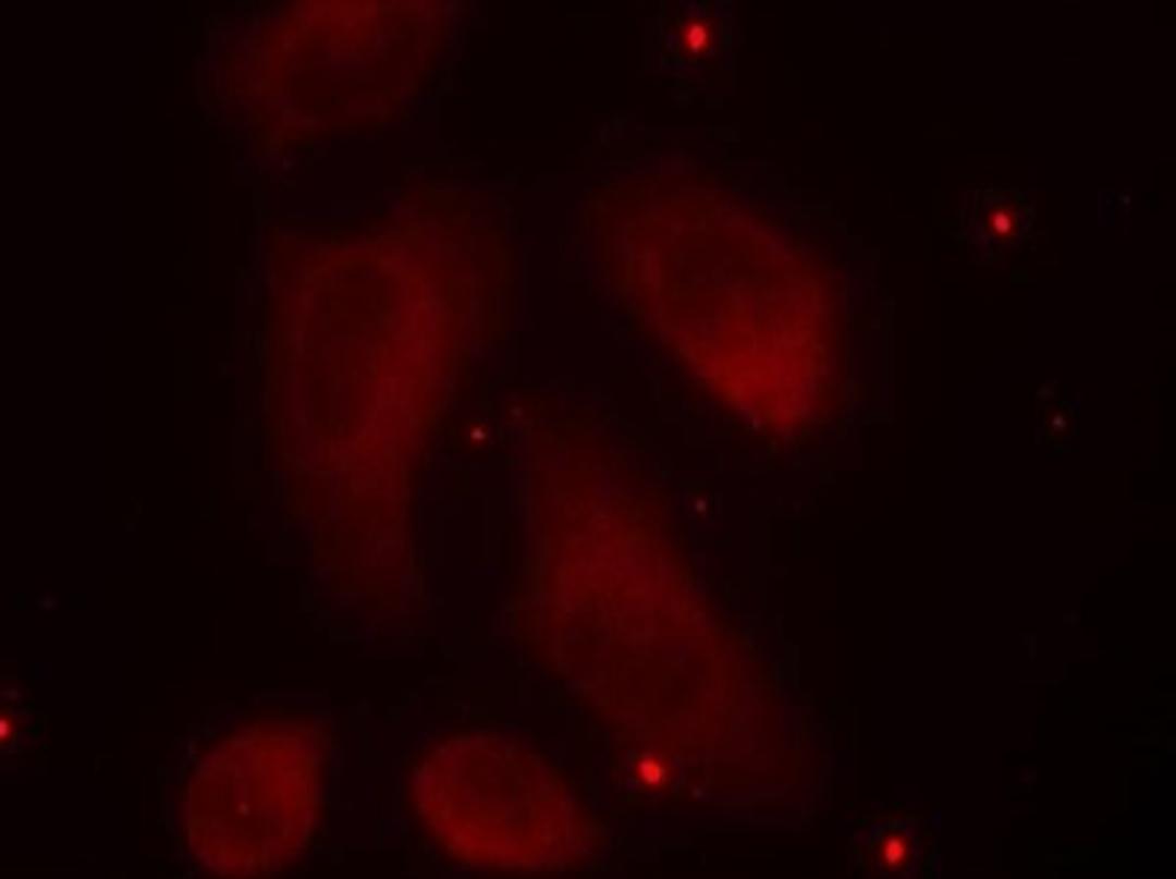 Immunocytochemistry/Immunofluorescence: LIM Kinase 1 [p Thr508] Antibody [NB100-82021] - Staining of methanol-fixed Hela cells using LIMK1(Phospho-Thr508) antibody