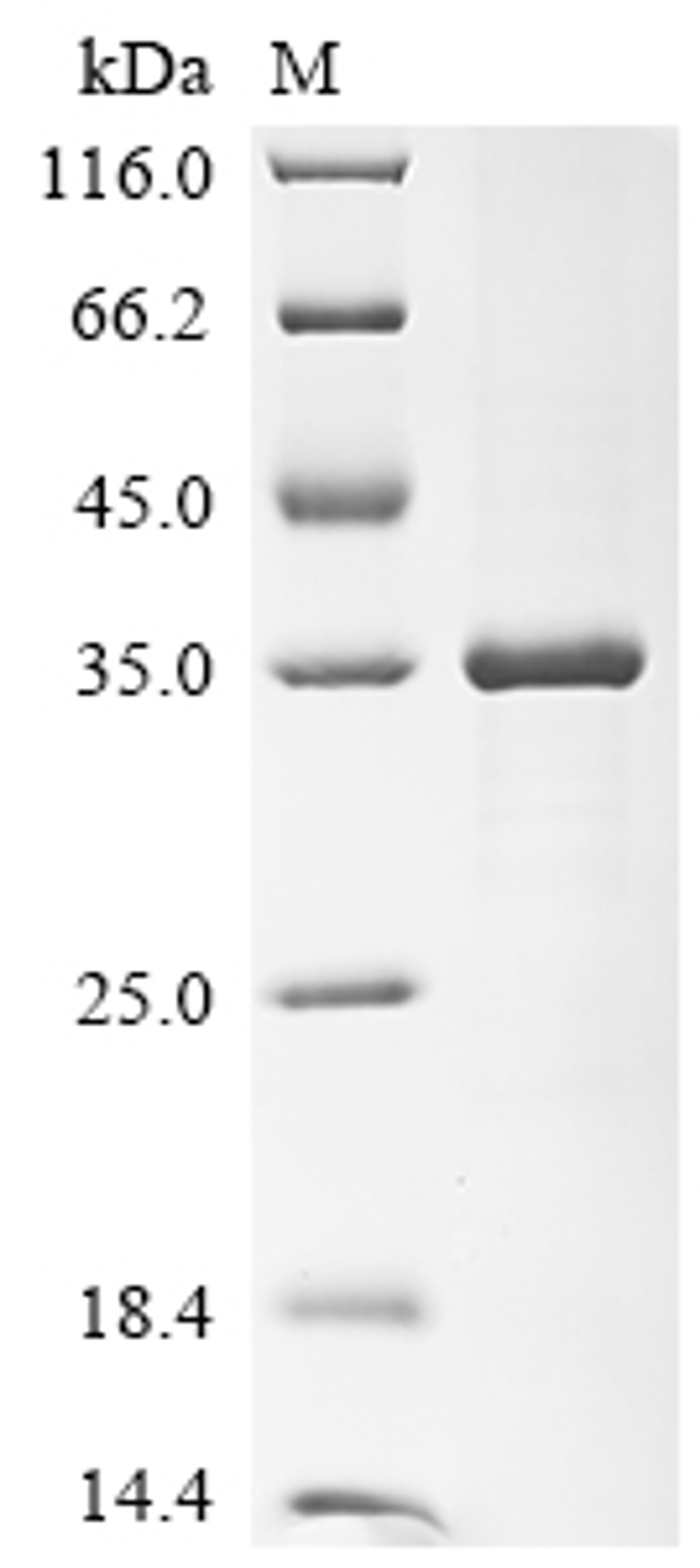 (Tris-Glycine gel) Discontinuous SDS-PAGE (reduced) with 5% enrichment gel and 15% separation gel.